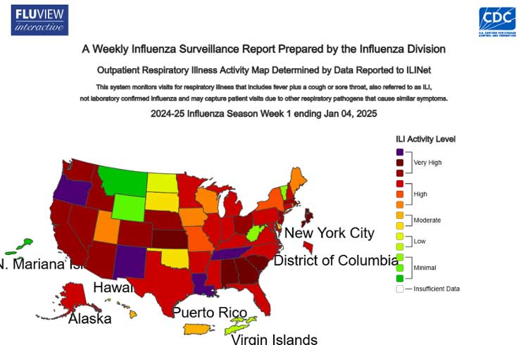 CDC flu map. 